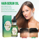 Nourishing Anti Hair Loss Thickening Hair Serum
