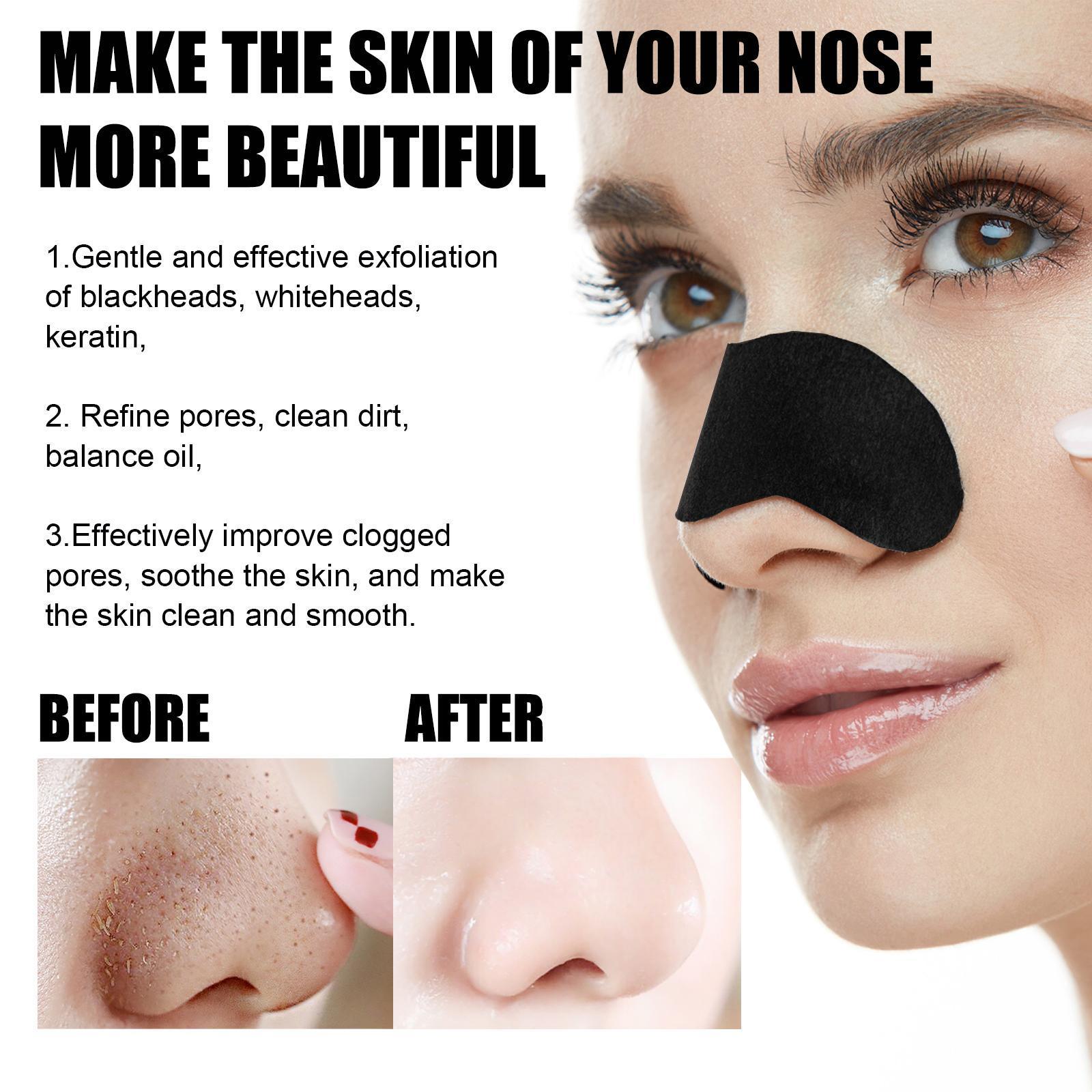 Blackhead Nose Pore Cleansing Strips