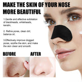 Blackhead Nose Pore Cleansing Strips