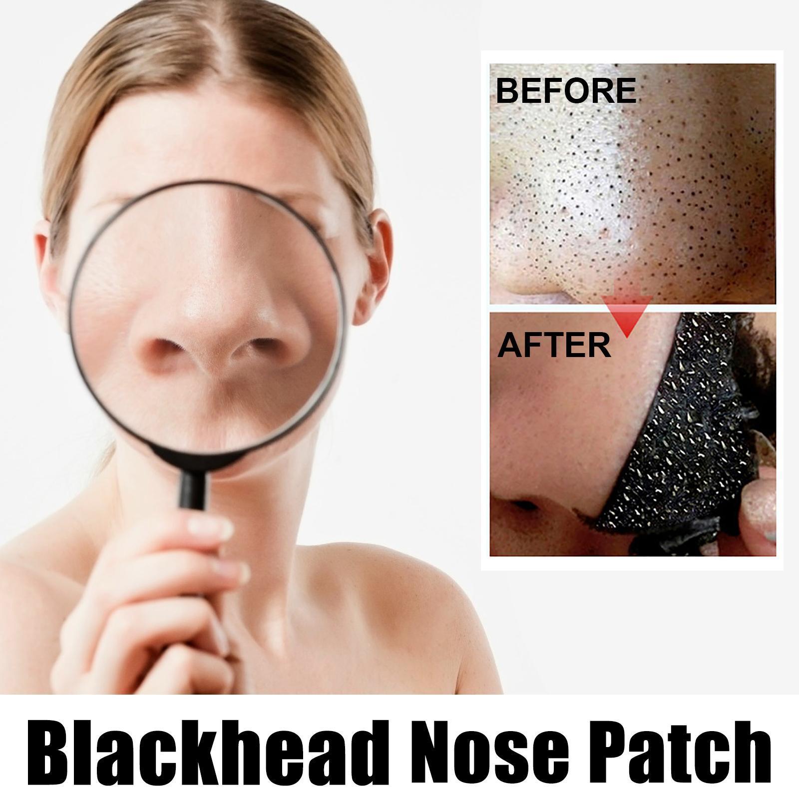 Blackhead Nose Pore Cleansing Strips