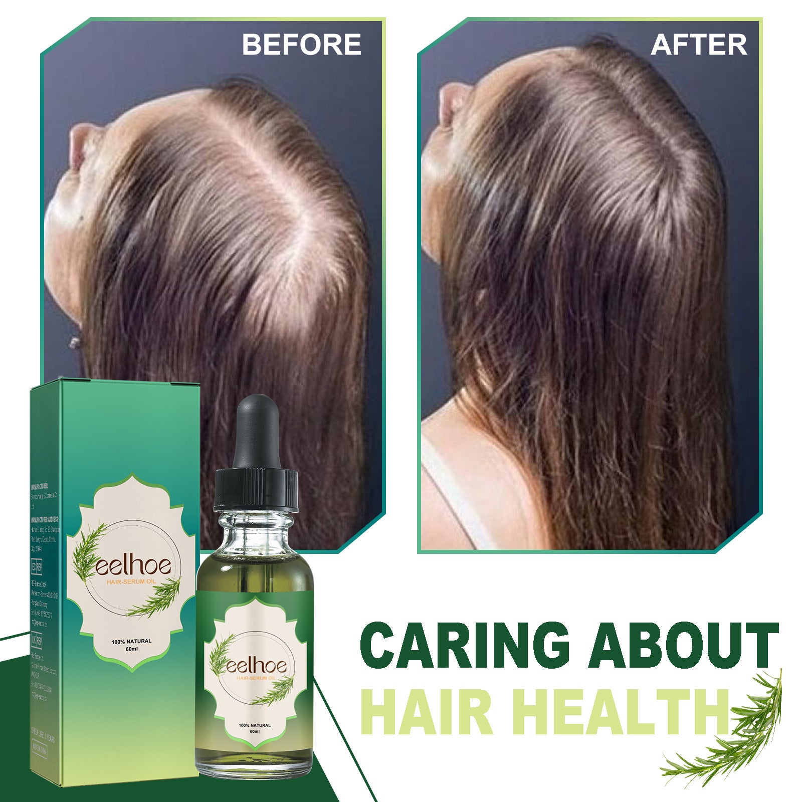 Nourishing Anti Hair Loss Thickening Hair Serum