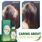 Nourishing Anti Hair Loss Thickening Hair Serum