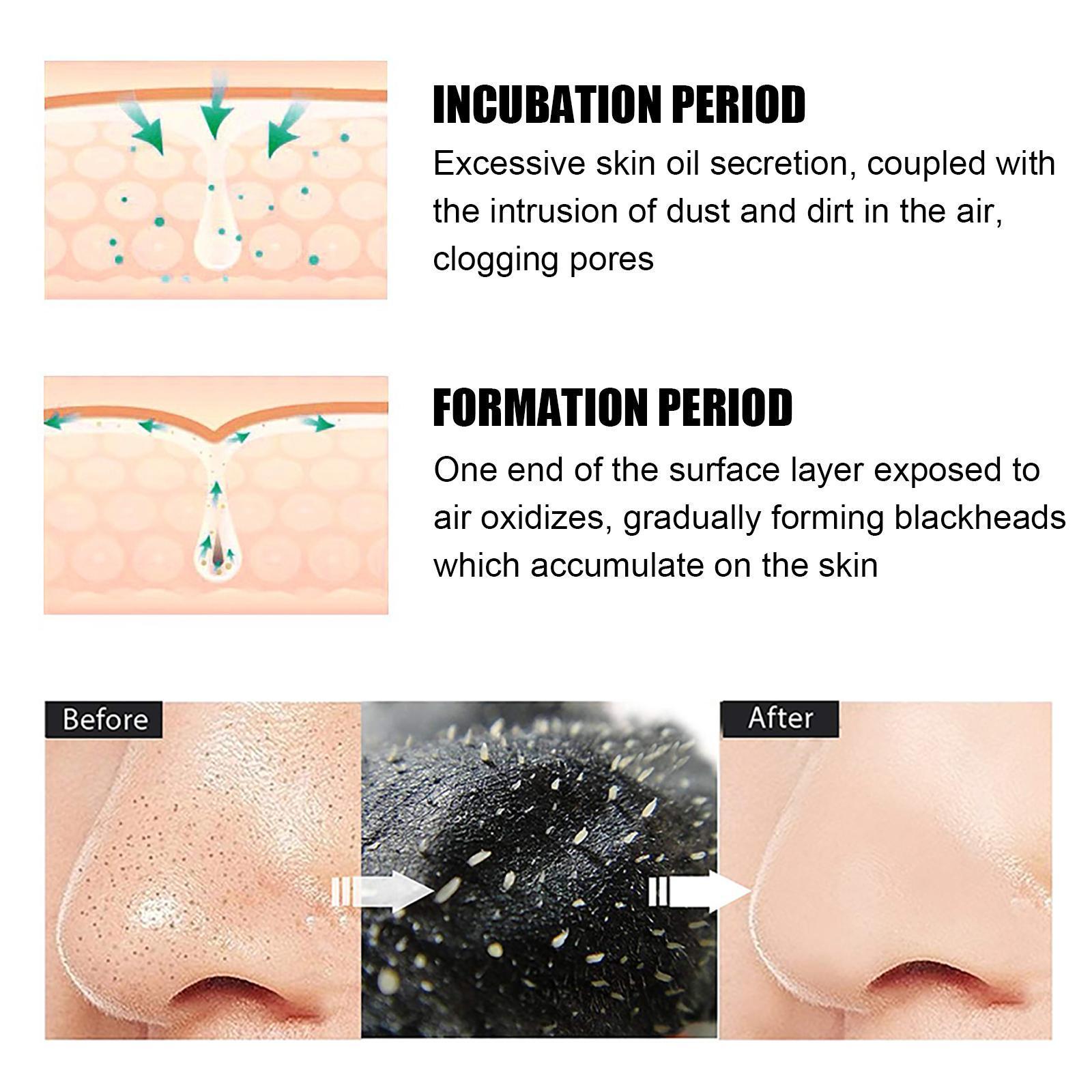 Blackhead Nose Pore Cleansing Strips
