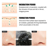 Blackhead Nose Pore Cleansing Strips