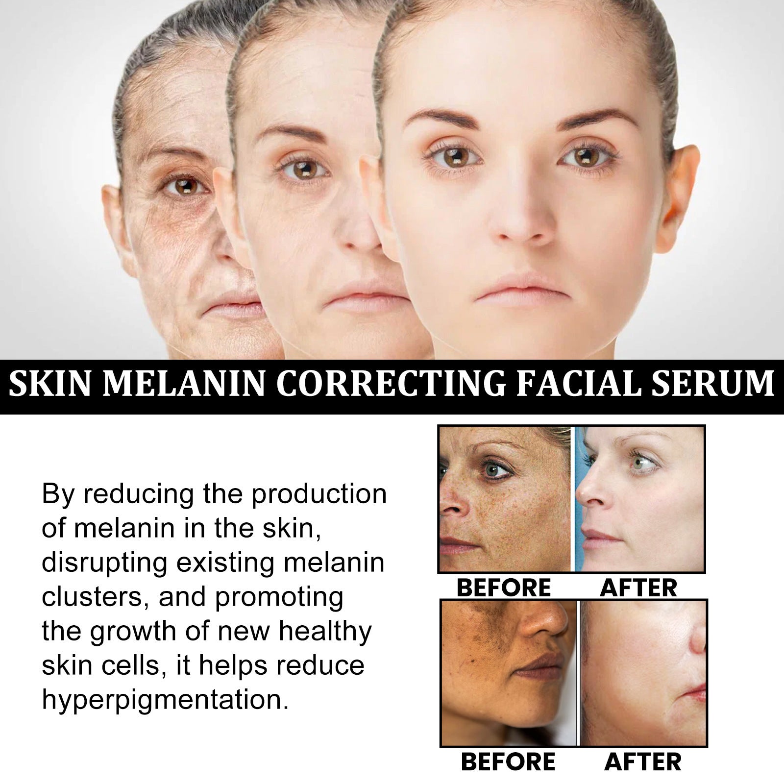 Facial Melanin Repair Hydrating Serum