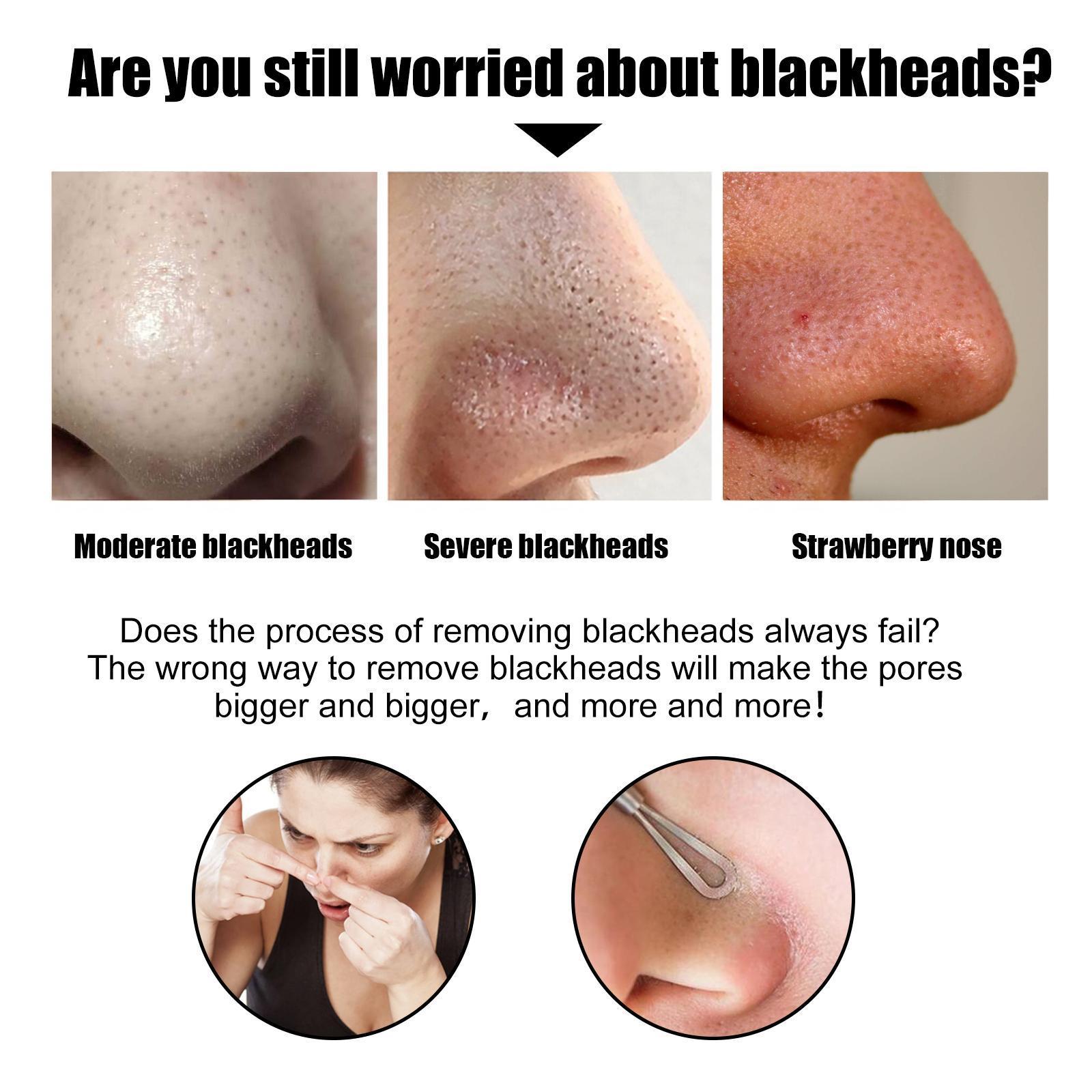 Blackhead Nose Pore Cleansing Strips